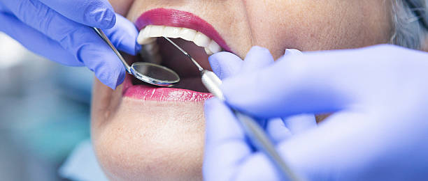 Best Emergency Dental Care for Broken or Chipped Teeth in Latham, NY